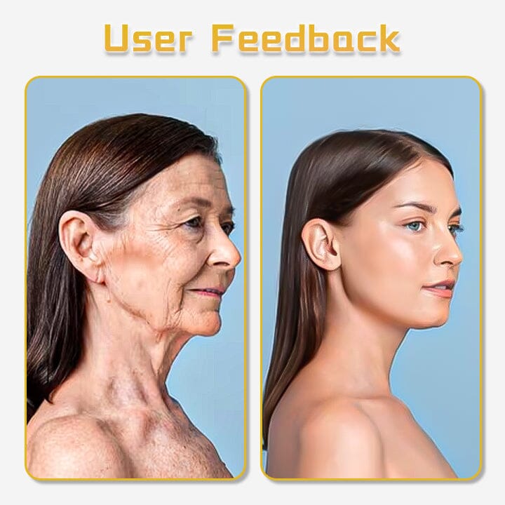 Biancat® UltraRenew Facial Toning Device