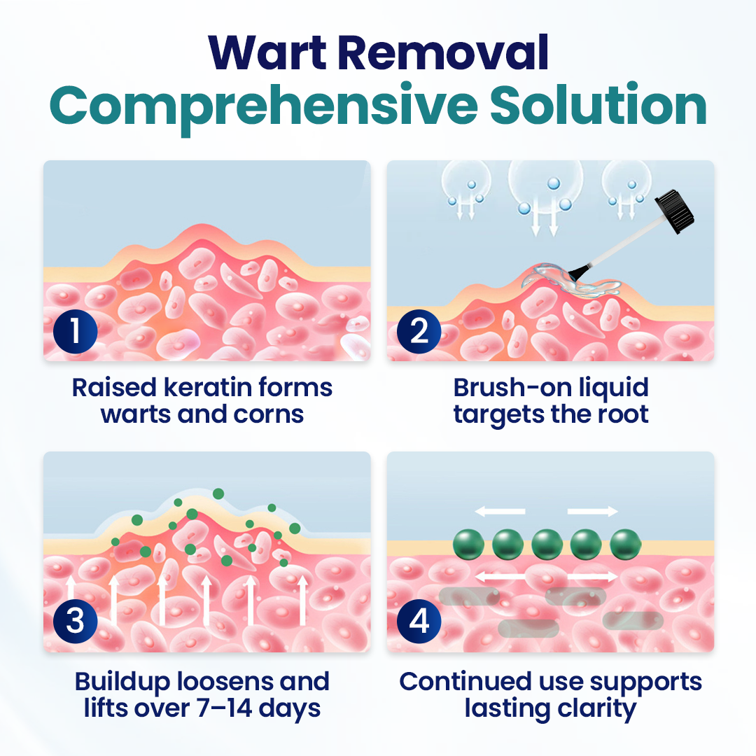 Timilk® WartLift Corn Removal Liquid 🔥