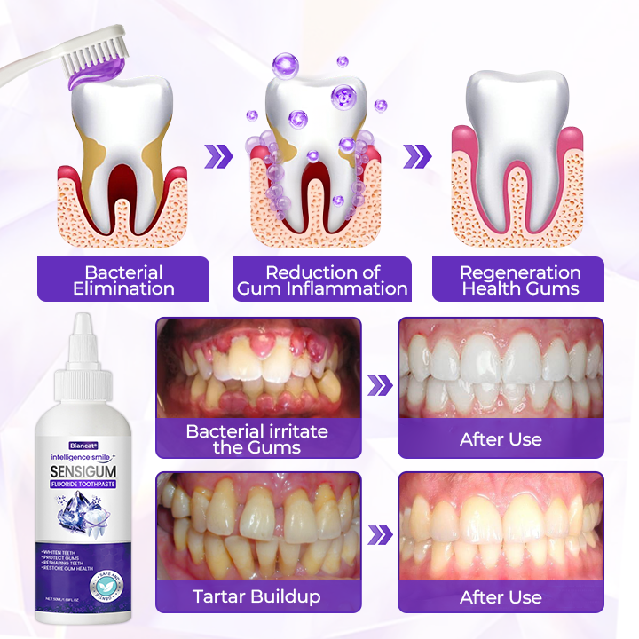 Biancat® SensiGum Fluoride Toothpaste