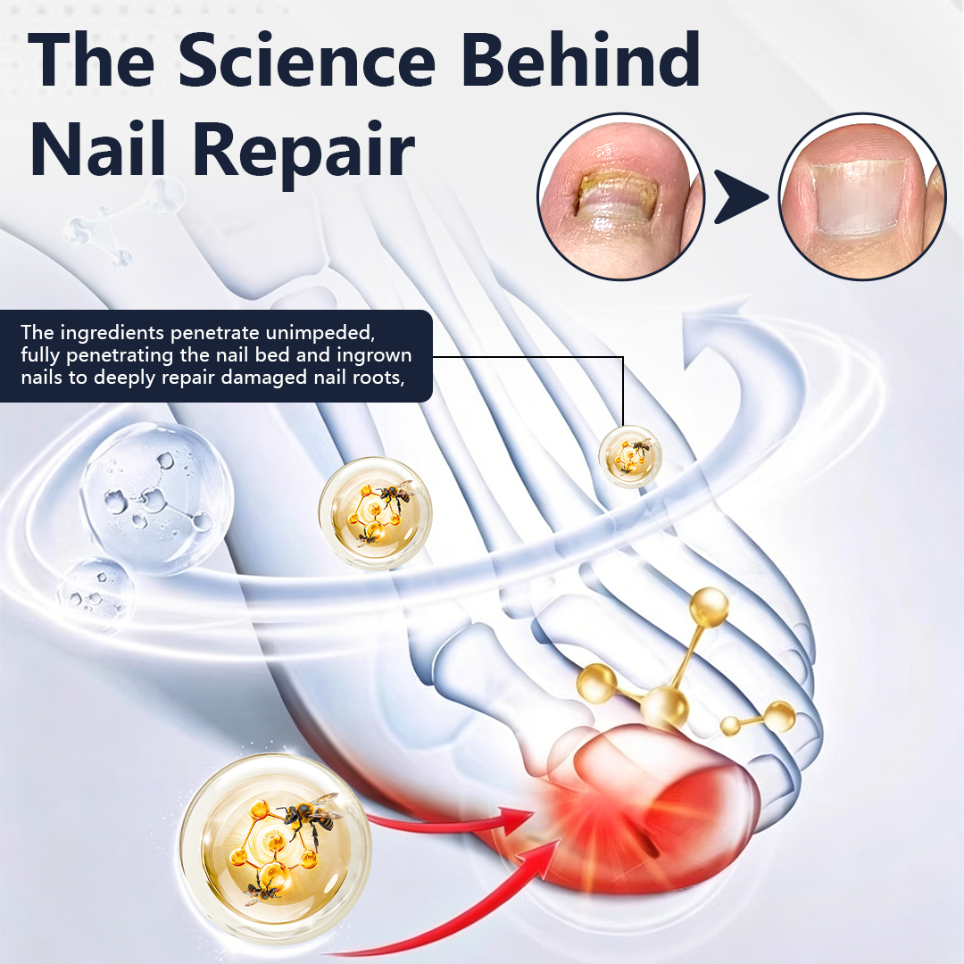 Ceoerty® NailFungiClear Pro Antifungal Pen
