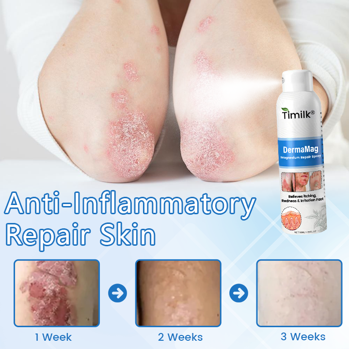 Timilk® DermaMag Magnesium Repair Spray 🔥