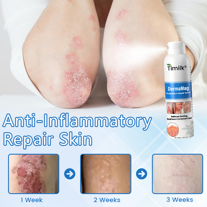 Timilk® DermaMag Magnesium Repair Spray 🔥