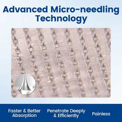 Timilk® Vein Ease Microneedle Therapy Patch - Fast ⚡Effective 💪 and Non-Invasive 🚫 Treatment for Varicose Veins & Leg Swelling 👣
