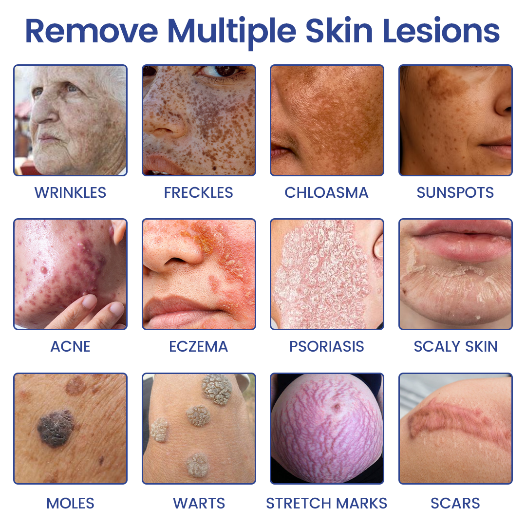 Timilk® 2-in-1 Microneedle Skin Repair Patch