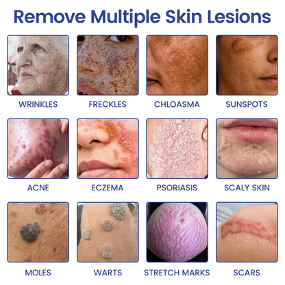 Timilk® 2-in-1 Microneedle Skin Repair Patch