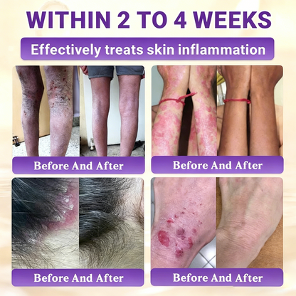 Timilk® BioColla DermaRenew Cream