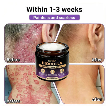 Timilk® BioColla DermaRenew Cream