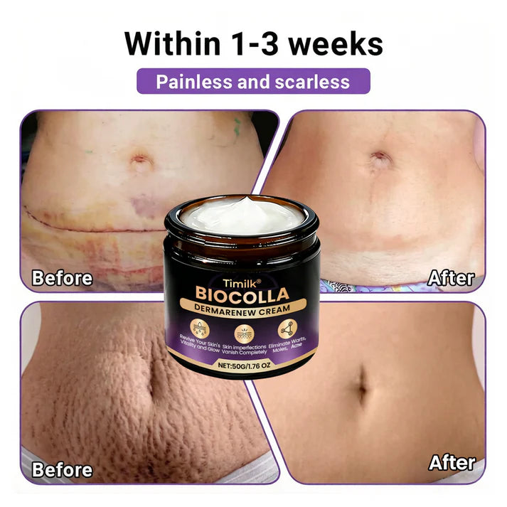Timilk® BioColla DermaRenew Cream