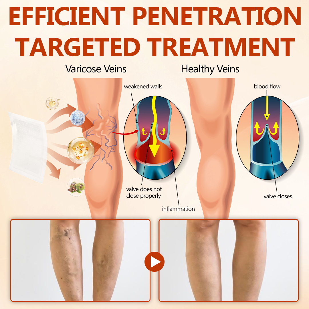 Timilk® VeinRepair Microneedle Patch Roll✨
