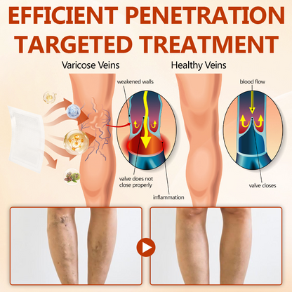 Timilk® VeinRepair Microneedle Patch Roll✨