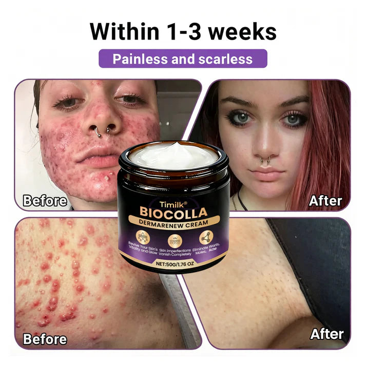Timilk® BioColla DermaRenew Cream