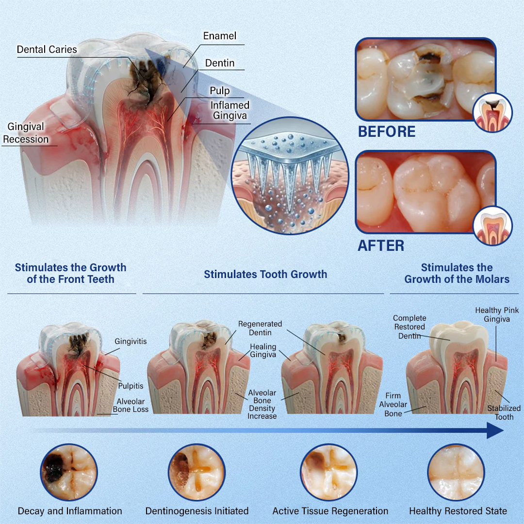 Ceoerty® Tooth & Gum Care Fast-Dissolving Microneedle Patch