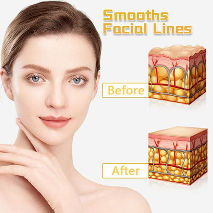 Biancat® UltraRenew Facial Toning Device