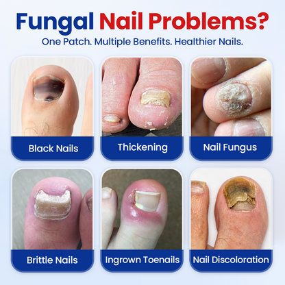 Biancat®Fungal Nail Repair Patches