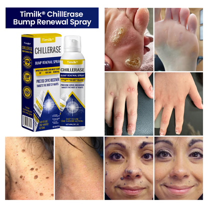 Timilk® ChillErase Bump Renewal Spray❤️