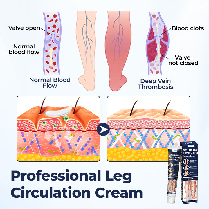 Timilk® SwellRelief Circulation Support Cream❤️‍🔥